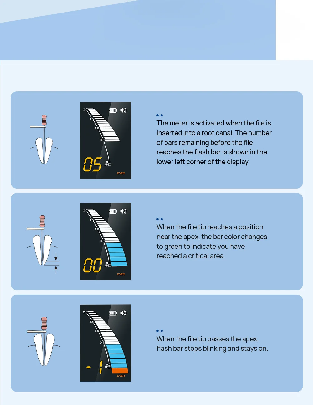 AZDENT Dentaler Wurzelkanal-Apex-Lokalisator, Endo-Apex-Ortungsgerät, Intelligentes Tragbares Messgerät, Zahnmedizinische Ausrüstung für Zahnärzte – Detail 3