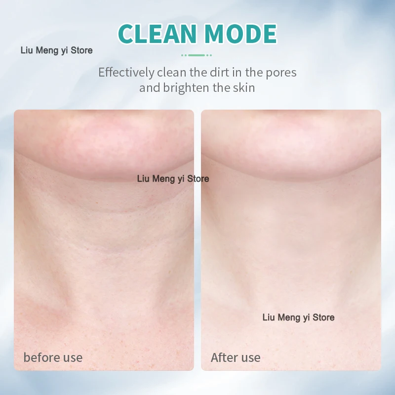 ANLAN الرقبة جهاز تجميل الوجه EMS الوجه الرقبة رفع 3 ألوان ضوء العناية بالبشرة شد الجلد تقليل الذقن المزدوجة أدوات العناية بالبشرة