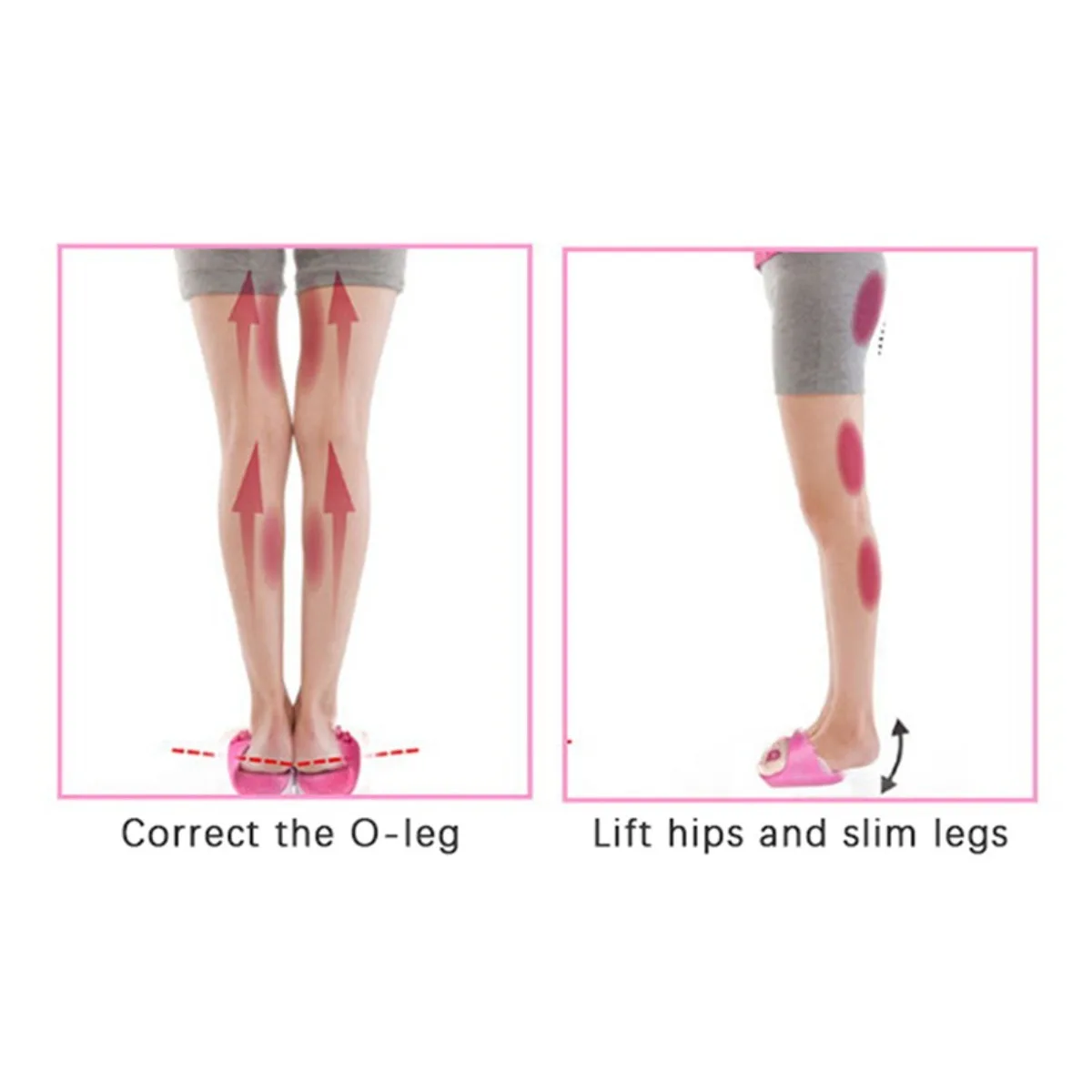 أداة سحرية عكسية وتصحيح القدم على شكل حرف O، تصحيح ارتداء نعل غير متساوٍ، شباشب مثمنة على شكل XO، مصحح للقدم المسطحة.