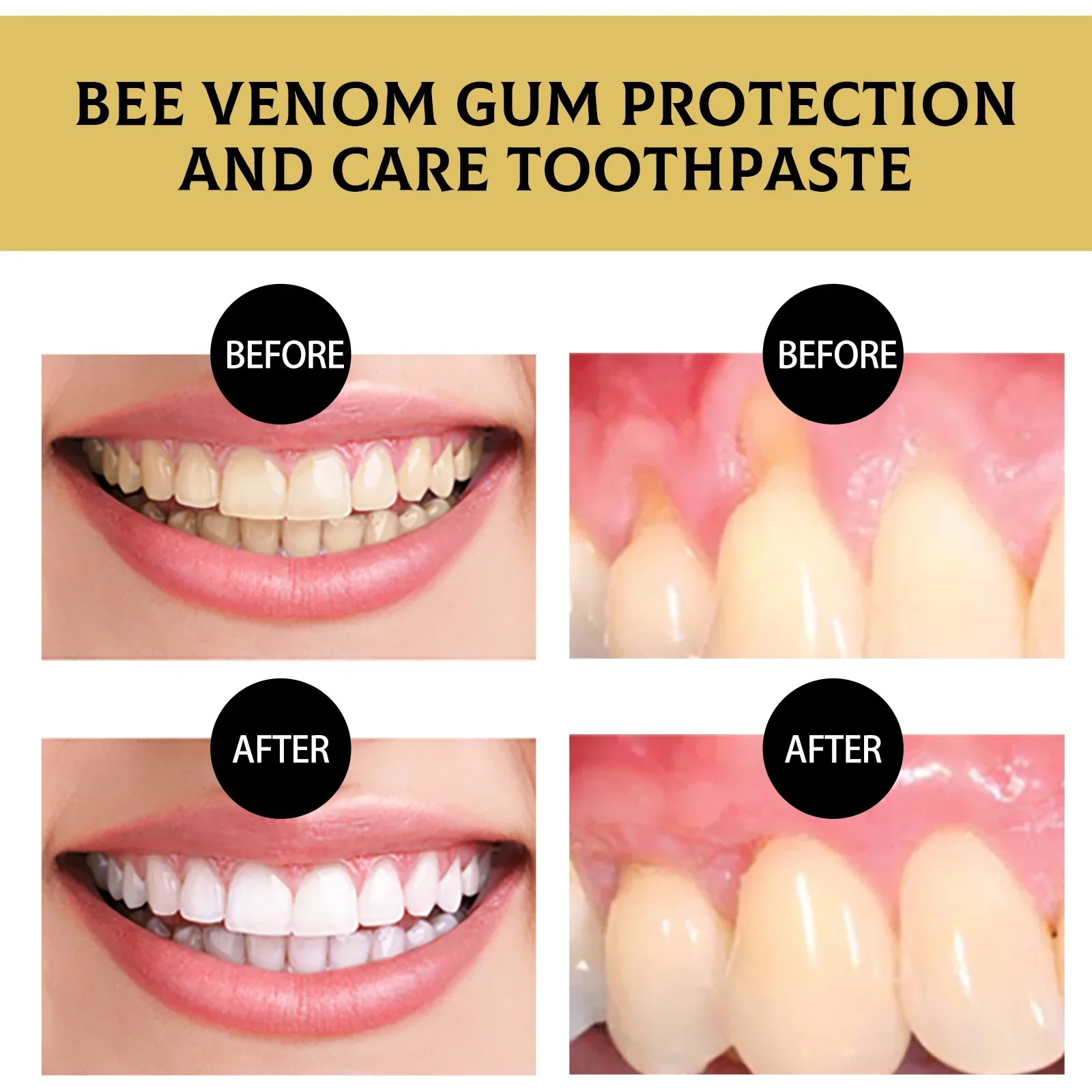 2pcs Bee Venom Gum Protection Toothpaste Whitening Toothpaste Tooth Cleaner Remove Yellow Teeth Remover Fresh Breath Dental Care