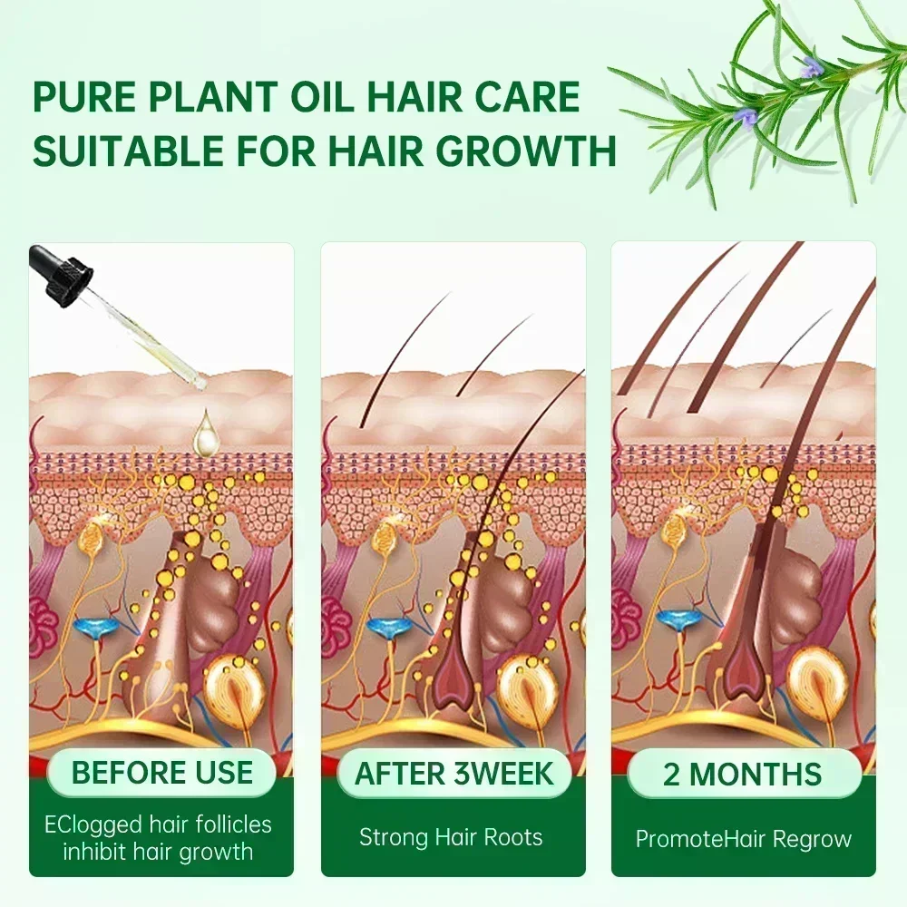 Produk penumbuh rambut Biotin Anti rambut rontok semprot kulit kepala perawatan rambut minyak esensial tumbuh cepat