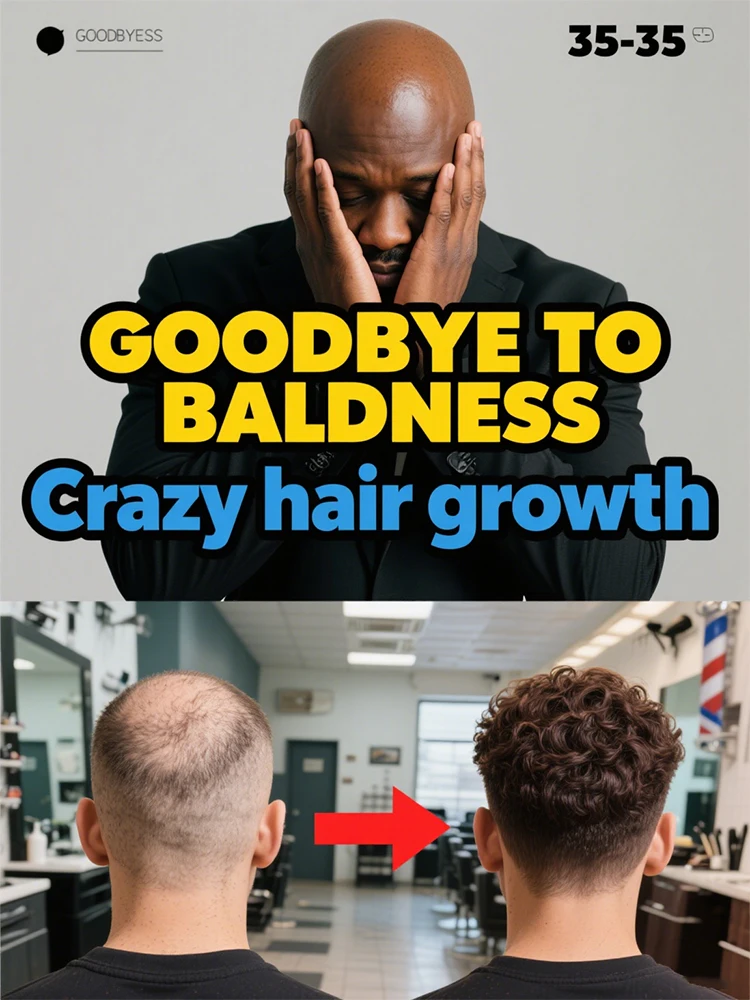 

Восстанавливающий гель Alopecia areata активирует фолликулы для волос и помогает новое выращивание волос.