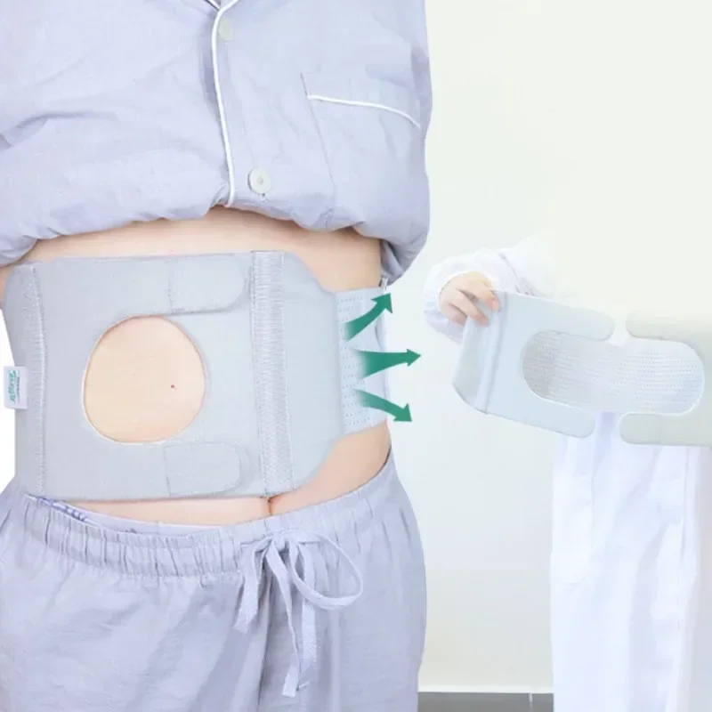 New Adjustable Ostomy Abdomen Wear Ostomy Pocket Medical Band Fixed Support Widened Elastic Care Waist Abdominal Auxiliary Strap