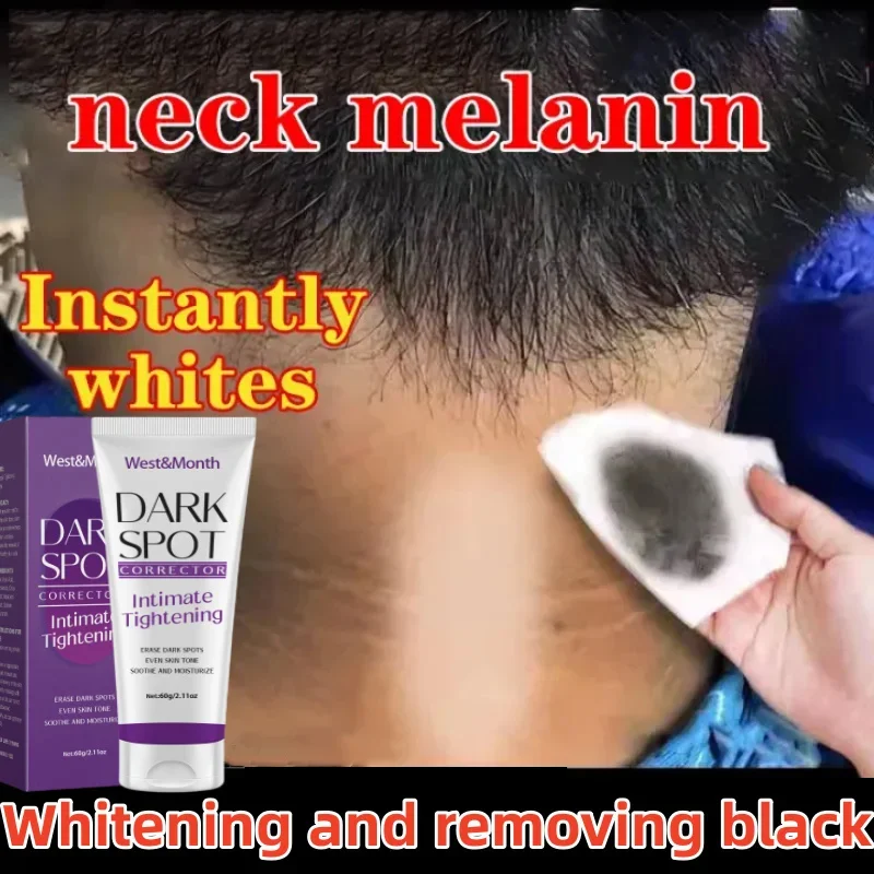 

Nicotinamide Brightening Cream Remove Melanin Dark Skin Brighten Cream Underarm Inner Thighs Elbows Bleach Joint Whitening Cream