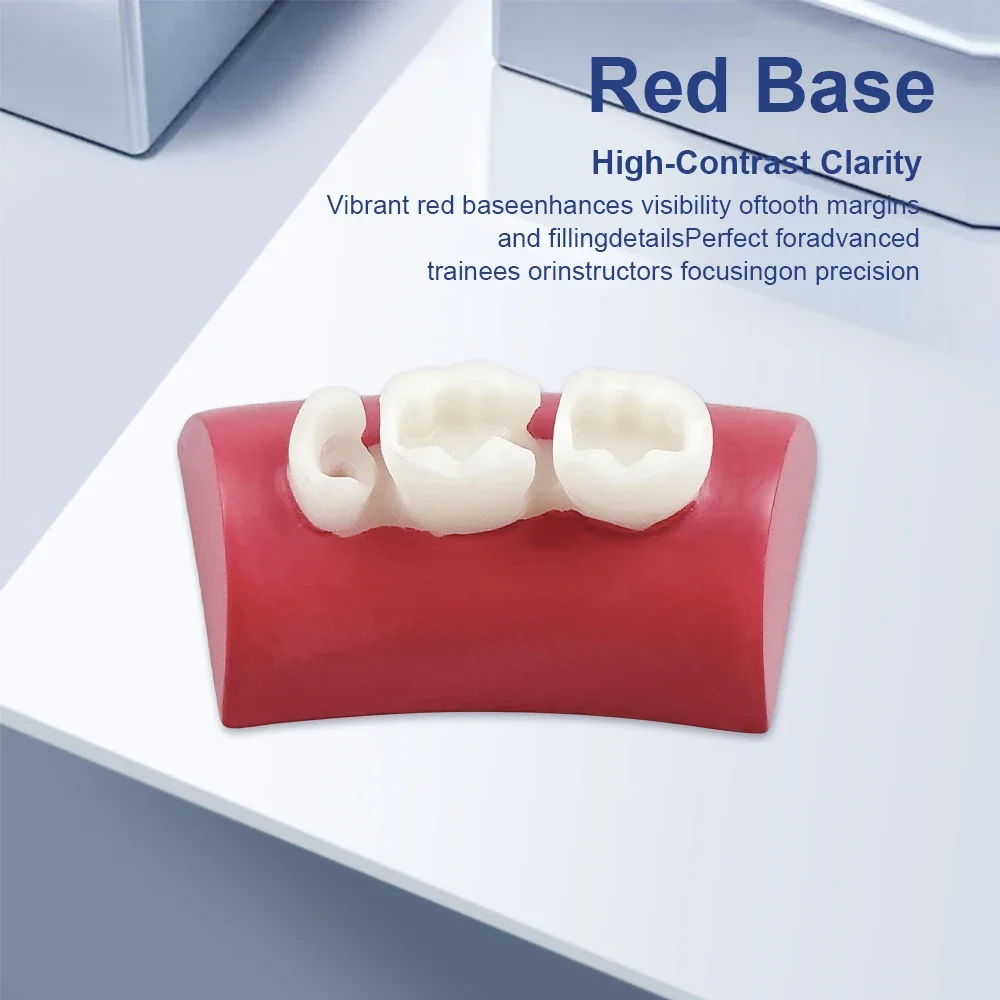 5pcs Dental Practice Filling Teeth Model Resin Filling Inlay Exercise Model Block Root Canal Prep Restoration Simulator Typodont