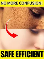 Effectively lightens dark spots and restores facial skin