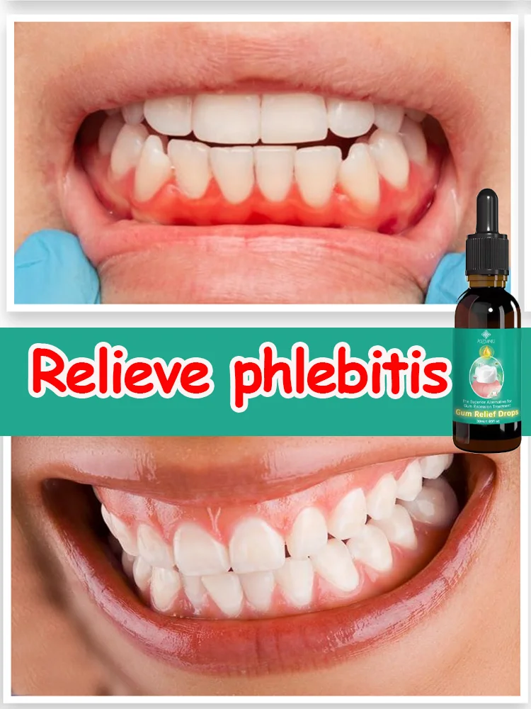 

Rapidly sterilizes, improves oral problems, eliminates red, swollen and bleeding gums, and eliminates bad breath. Freshens breat