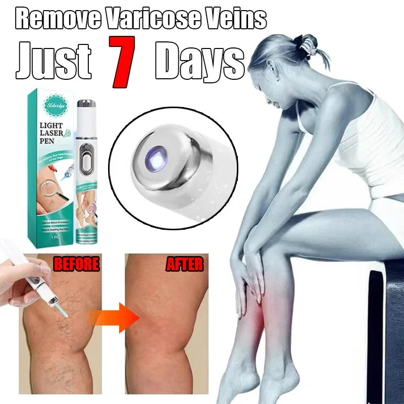 

Лазерная ручка с синим светом для варикозного расширения вен, высококачественный терапевтический инструмент, флебит, васкулит, улучшает кровообращение, уменьшает отеки