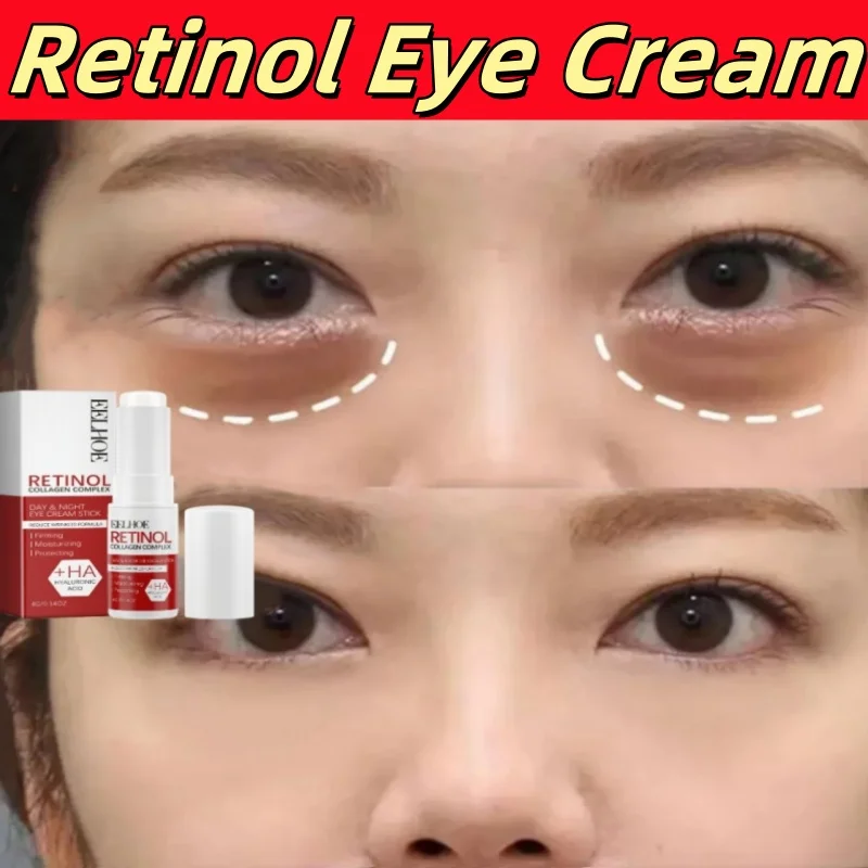 

Retinol Eye Cream Collagen Multibalm Stick Reduce Wrinkles Eye Bag Hyaluronic Acid Anti Dark Circle Puffiness Firming Eye Care