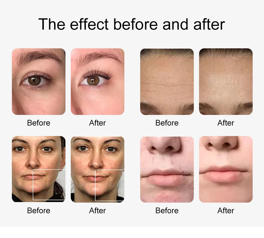AOKO Neue 12 IN 1 Hydro Dermabrasion Aqua Peeling Ultraschall Gesichtspflege Sauerstoff Injektion Hautverjüngung Wittling Schönheitsmaschine – Detail 13