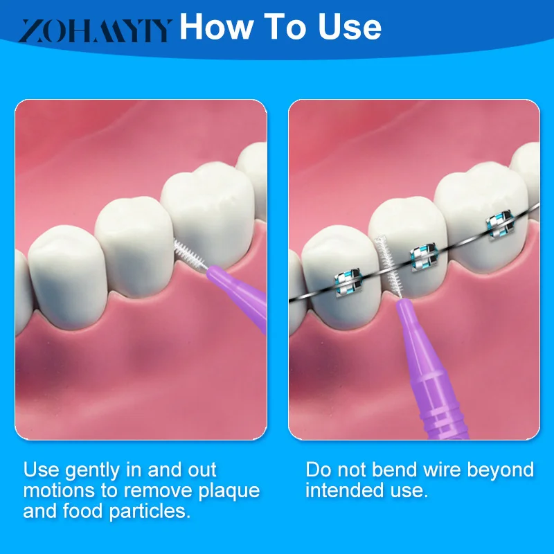 10 Stuks Interdentale Borstels Gezondheidszorg Tanden Whitening Interdentheelkundige Reinigers Orthodontische Tandborstel Mondhygiëne Tool