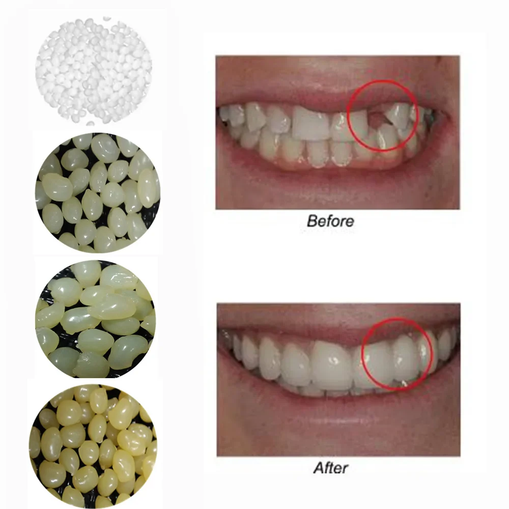 Falso dentes falsos enchimento, reparo do dente, sorriso snap em folheados, dentaduras caso, colar grânulos adesivos, cosméticos, 4 cores