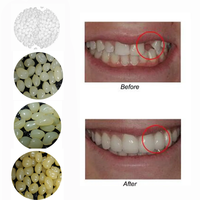 4 Colors Dental Oral False Fake Teeth Tooth Filling Repair Smile Snap on Veneers Dentures Case Paste Adhesive Beads Cosmetic