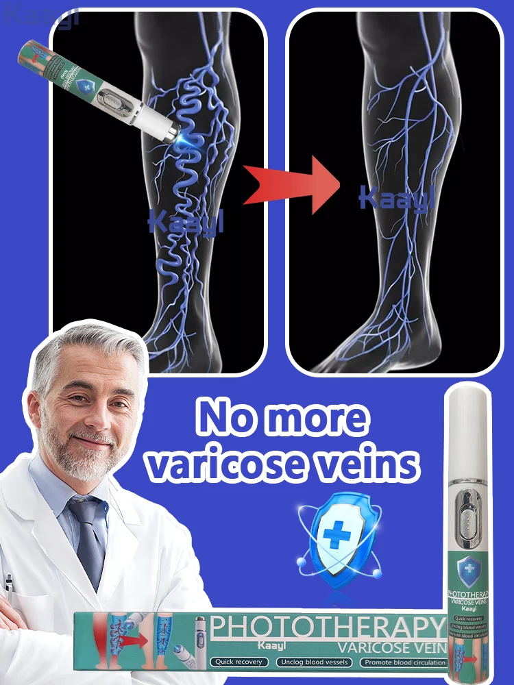 

Improves Blood Circulation| Laser vein| Varicose vein laser pointer