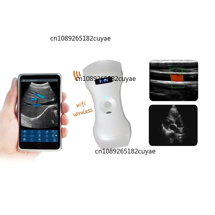 Medical Ultra-sound Wireless 3-in-1 Handheld 192-element Veterinary Ultra-sound Machine Convex Linear Wireless Ultra-sound