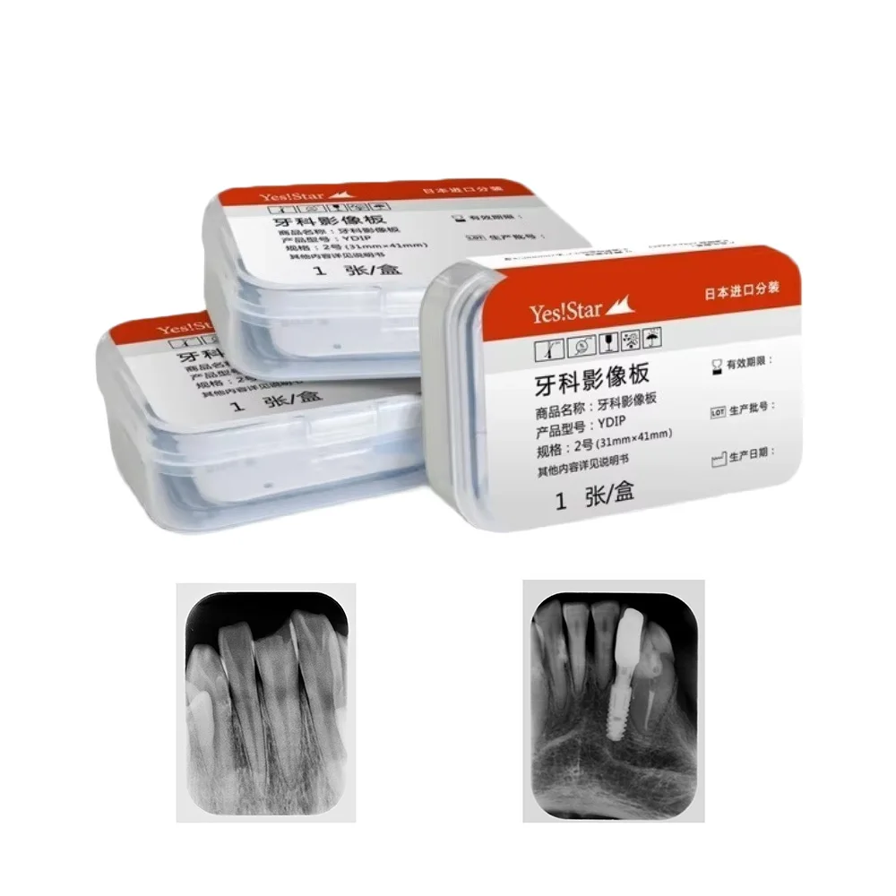 Intraoral Dental Phosphor Imaging Plate Size 0 1 2 Wireless Magnetic PSP Film Reader For Woodpecker Fussen Apixia Dental Scanner