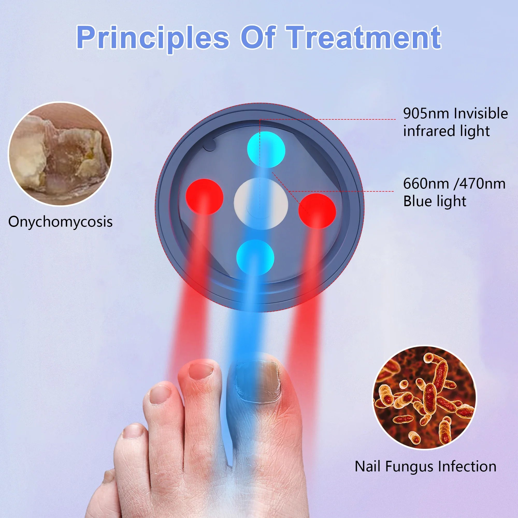 Nail fungus laser therapy device, USB charging, onychomycosis treatment, treatment machine, neutral foot care tool