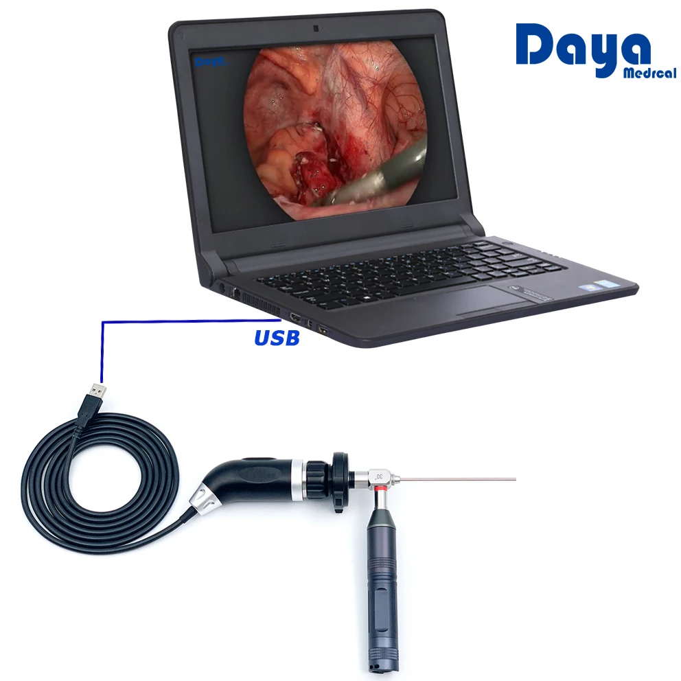 

ENT Clinic Doctor Favorite Portable USB Medical Endoscope Camera for ENT PTED Urology Fiberscope