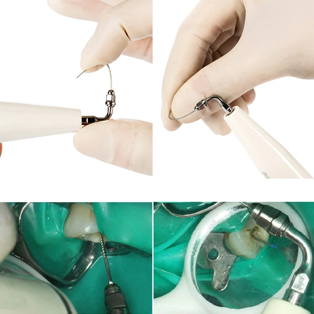 Picture 4: 6pcs/Bottle Dental U Files Root Canal Endodontic Files NITI with Scaler Tips E1 E2 For EMS Woodpecker Ultrasonic Scalers