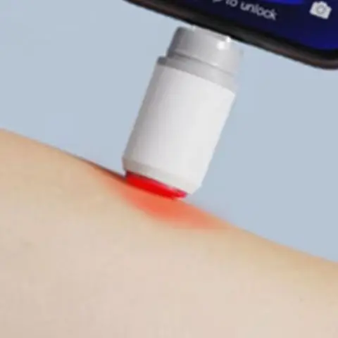 Electronic Mosquito Bite Pen Natural Mosquito Bite Heat Pen Chemical-Free Electric Insect Bite Healer for Camping Travel Outdoor