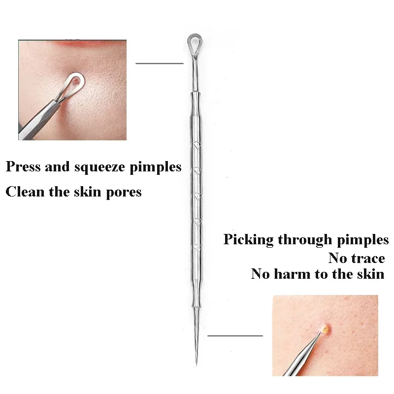 1-5pc Mitesser Entferner Pickel Popper Werkzeug Akne Nadel Entfernen Behandlung Whitehead Popping Zit Nase Gesicht Makel extractor-Tool