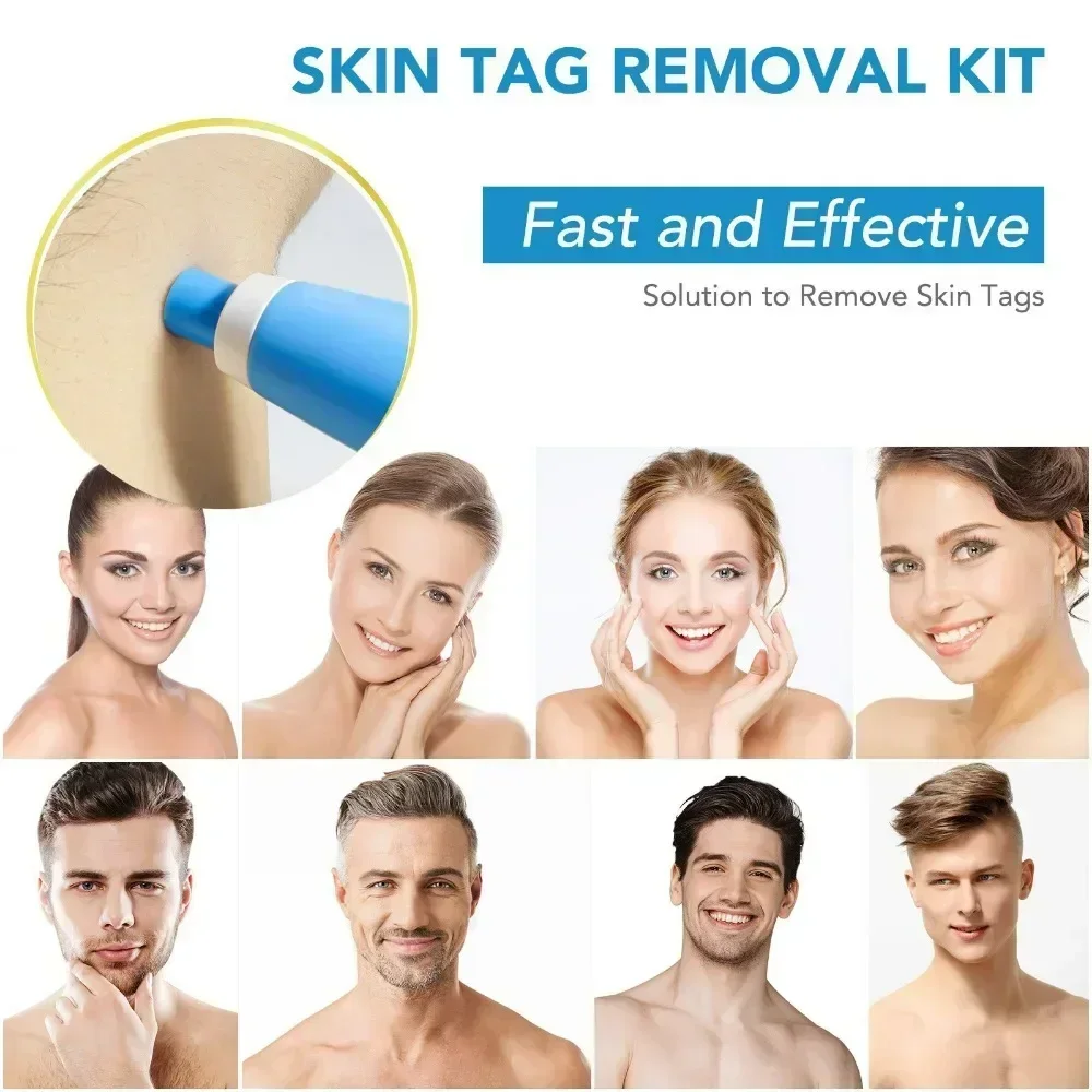 2-IN-1 Auto Skin Label Mole Acne Wart Removal ปากกา Skin Tag Removal ชุดเครื่องมือไม่เจ็บปวดด้วยทําความสะอาด Swabs Facial Skin Care เครื่องมือ