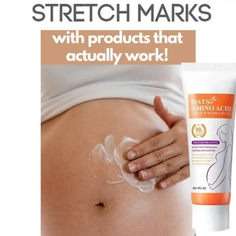 Stretch Marks Remover Pregnancy Maternity Body New Old Stretch Remove Marks Lifting Firming Increase Elasticity Of Skin