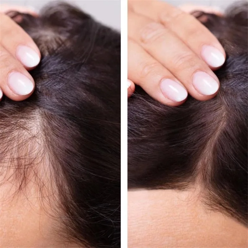 2023 Biotin Fast Hair Growth Oil  Regrowth Serum  Thinning Treatment   Liquid Anti- Loss for Women & Men view 4