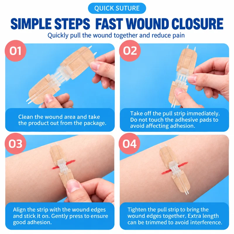 Zipper Wound Closure Patch Suture-free Zip Suture Reducer Painless Band Aid Outdoor First Aid Dressing