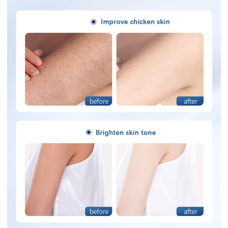 300ML Niacinamide Body Repair Cream Moisturizing Nourishing Water Locking Improves Dry Rough Uniform Skin Tone Soothes Body Care