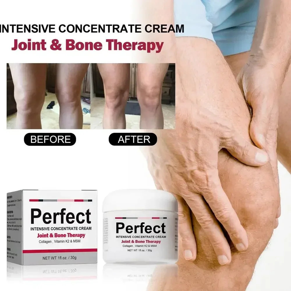 Crema ortopédica para aliviar el dolor de los huesos de las articulaciones, Corrector de Valgus, ungüentos para tratar los músculos de la rodilla, 50G