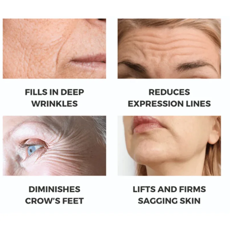 Hot Selling Moisturizing And Anti-aging Collagen Freeze-dried Powder Ball For Children's Skin Silk Collagen System