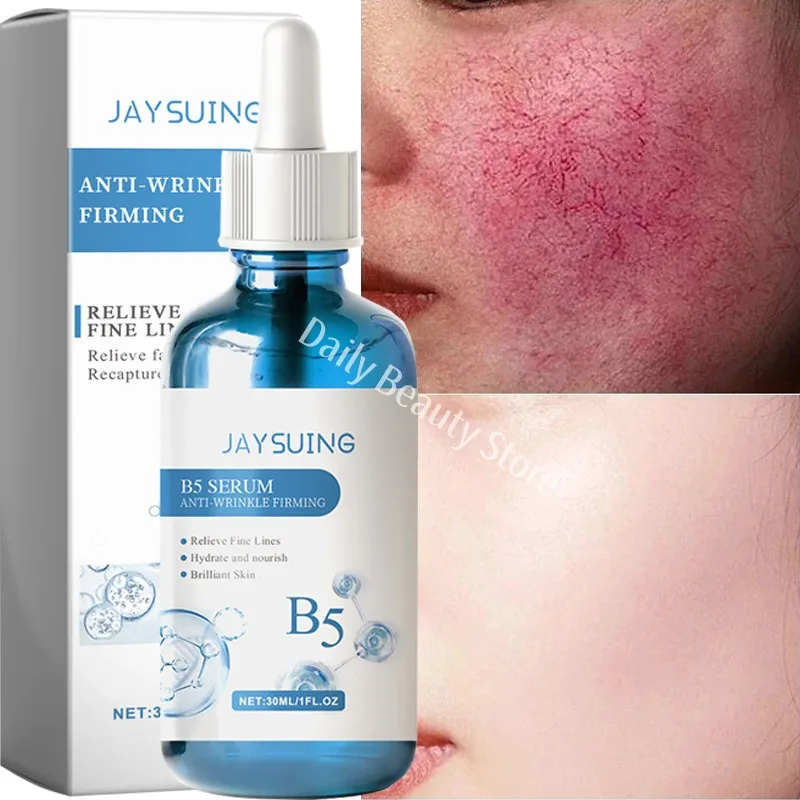 Repair Facial Redness Serum Instant Spider Vein Remove Sensitive Skin Sooth Anti Redness Rosacea Treat Lotion Korean Cosmetics