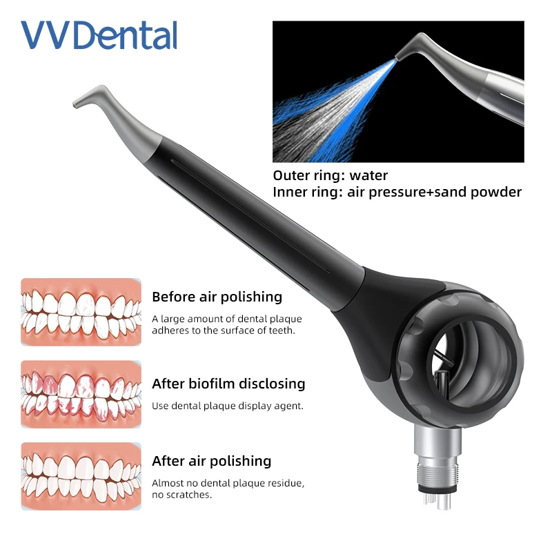 

VV Dental Sandblasting Gun Air Polisher Prophy Jet Powered Tooth Cleaning Polishing Alumina Pen 2/4 Holes Dentistry Tools