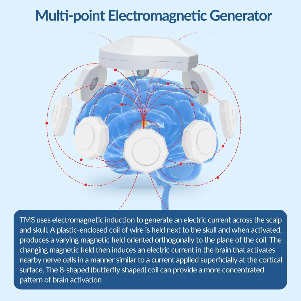 ZJZK 40Hz RTMS Transcranial Magnetic Stimulation Device Alzheimer Early Intervention Household Rehabilitation Instrument