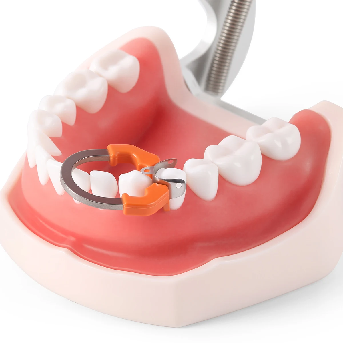 AZDENT Dental-Sektionsmatrixsystem, konturierte 50-teilige Matrixbänder M4, universeller Klemmring R7, NiTi D3 Set für Zahnmedizin – Detail 6