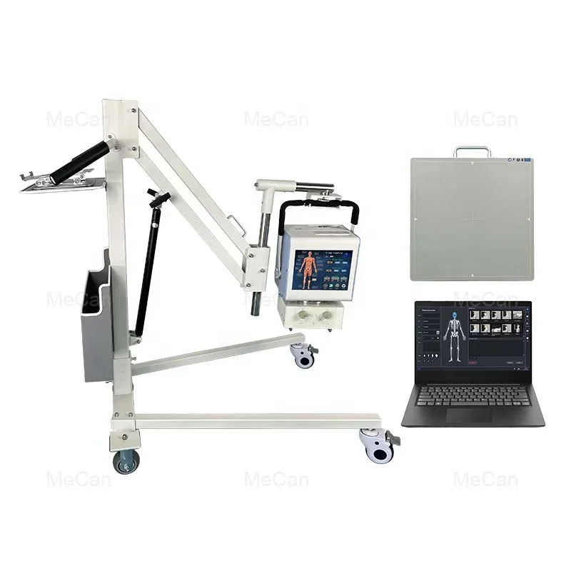 Digital Mobile Xray Machine Medical Diagnostic X-ray Equipment High Frequency 5KW 100MA Portable X-ray