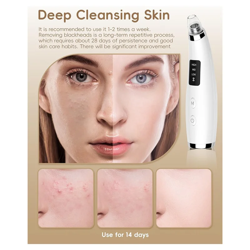 M17K-Blackhead Remover Tools Blackhead Remover Vacuum Extraction Tools Forestheticians