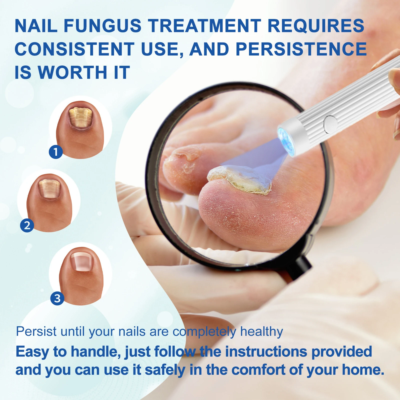 Repair Fast Nail Fungus Onychomycosis Fungus Nail Laser Device Fungus Cleaning Laser Device Remove Nail Fungus Cure Ingrown Tool