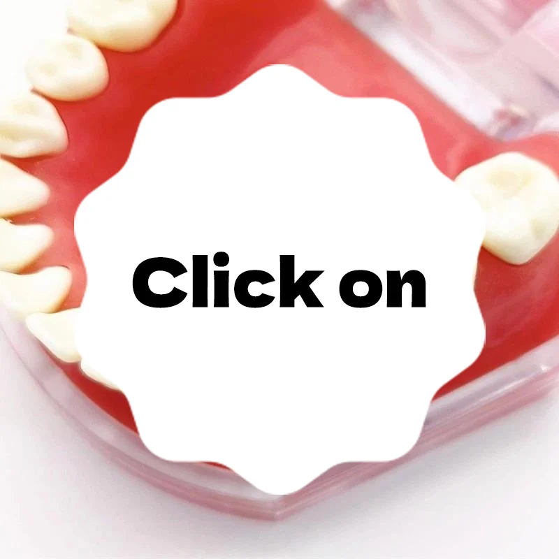 

Зубной имплантат, параллельный штифтовый калибр, медицинский локатор из нержавеющей стали, руководство по установке зубного имплантата, линейка для поиска