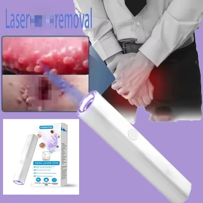 

Stylo Laser de Stimulation des follicules pileux, soins de la peau,Protect Your Health