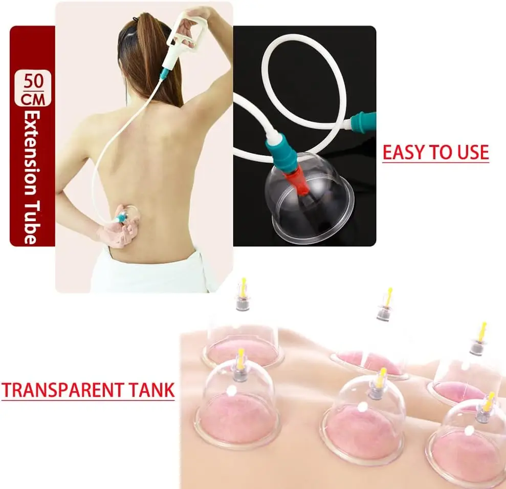 32 Pieces Professional Vacuum Acupuncture Cupping Massager Chinese Acupoint Physical Vacuum Cupping Therapy Cans Anti-Cellulite