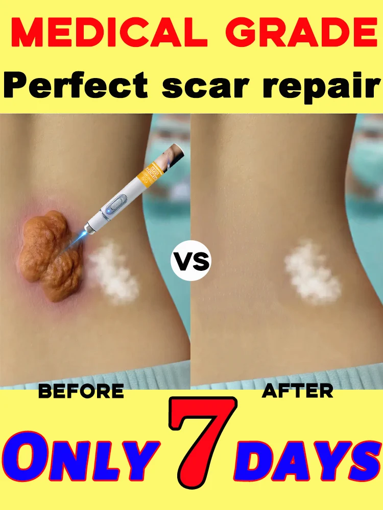 

Medical grade safety makes scars disappear and solves your problems