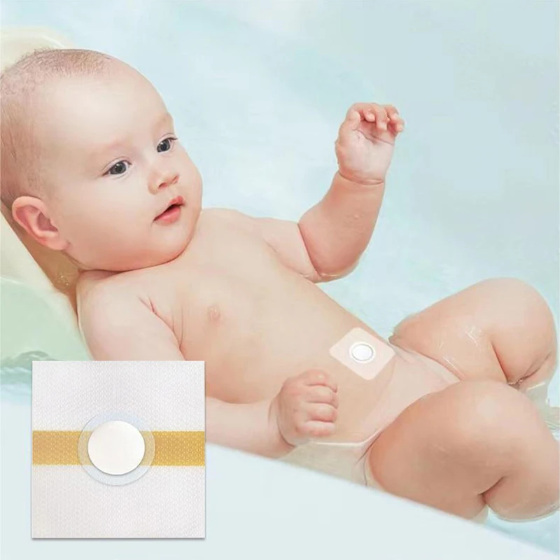 Baby Navelstickers Bad Voorkomen Infectie Pasgeboren Navelbescherming Navelbreuk Patch Hernia Pad