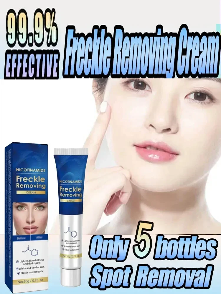 

Freckle Removing Cream Blemish Reduces Chloasma Age Spots Dark Spot Sun Spots Lightening Face Cream Korean Skin Care