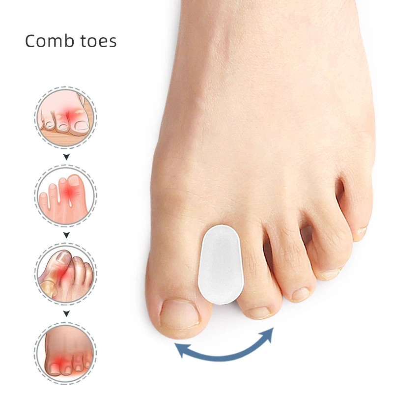 Pemisah Gel silikon jari kaki 3 pasang, korektor penghilang nyeri, pelurus pedikur Bunion Hallux Valgus