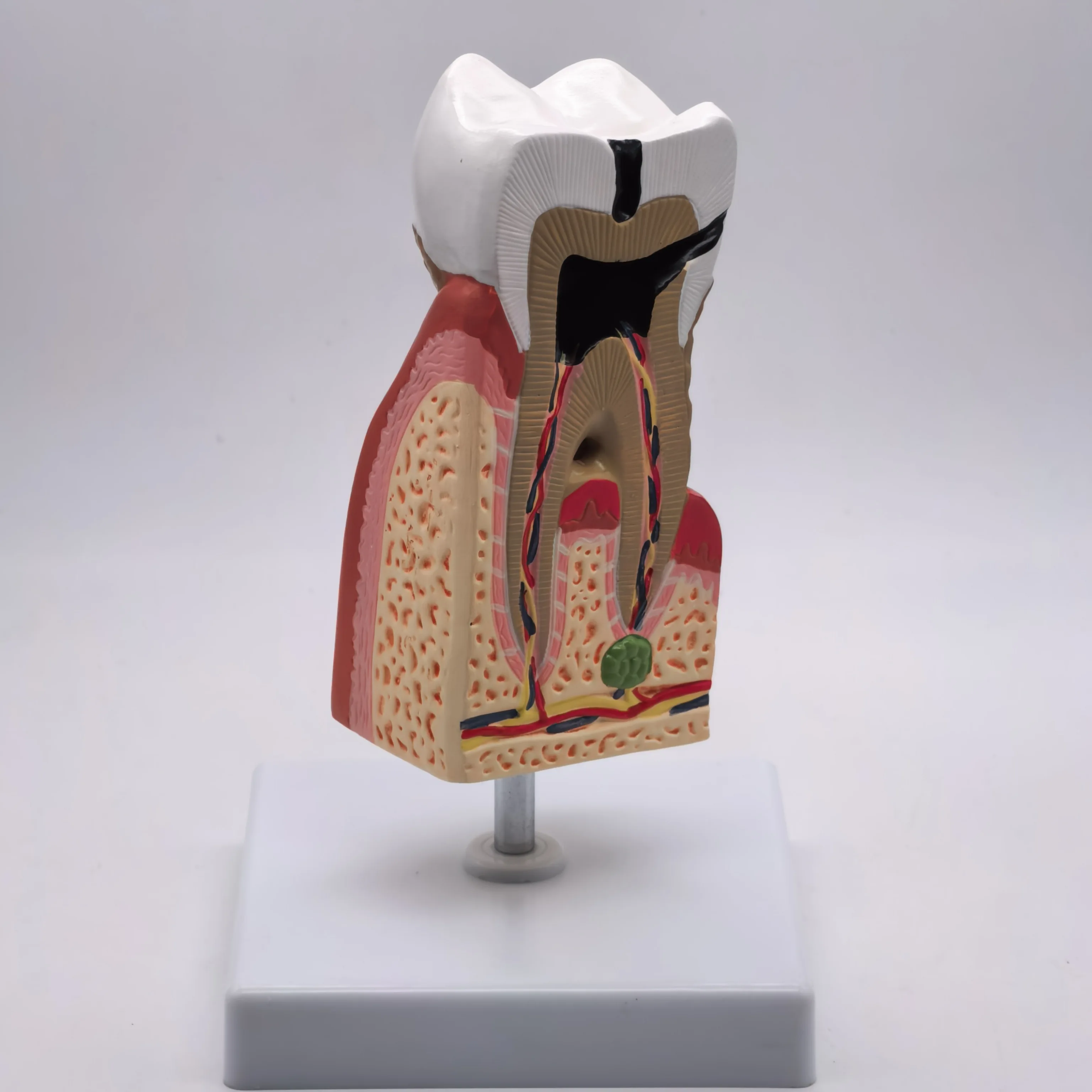 Anatomia médica do modelo anatômico dos dentes malezas humanos do PVC para a educação do paciente