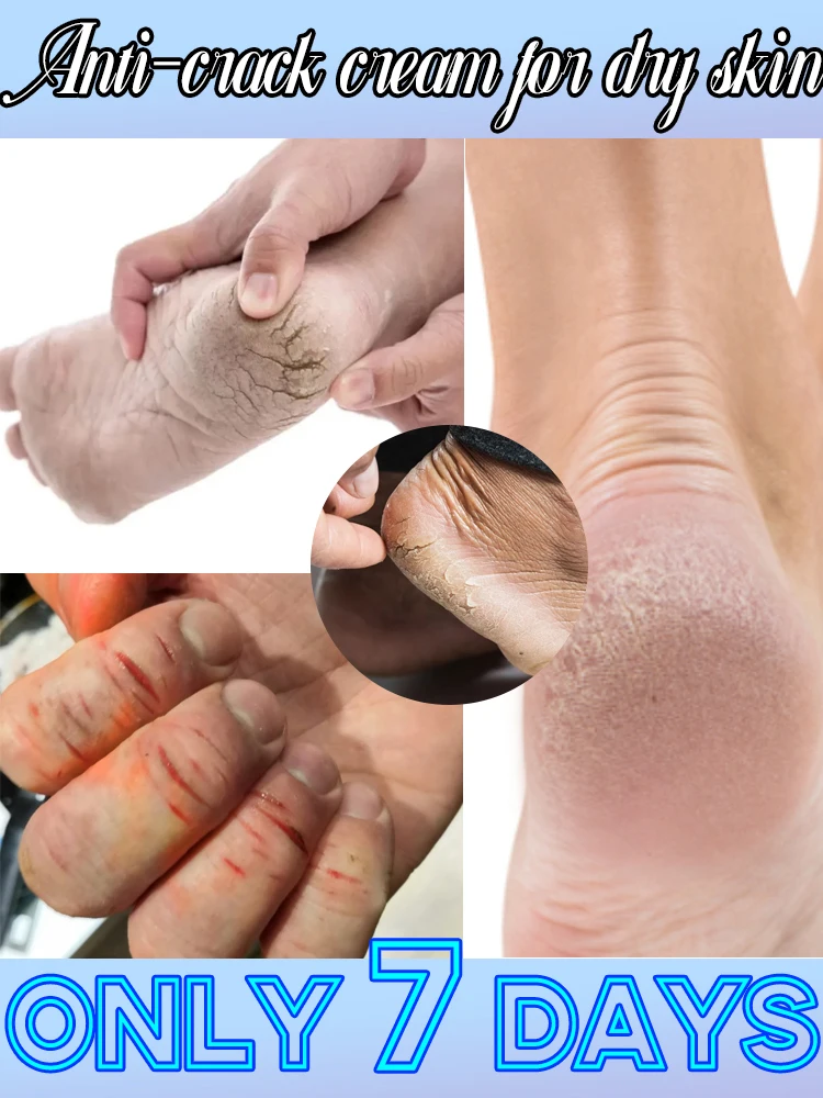 

Hydrating and nourishing foot care for dry, cracked skin.