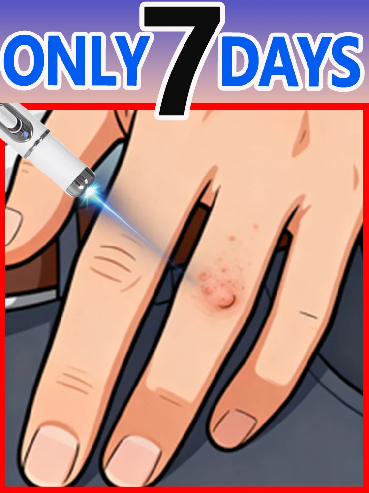 

Инструмент Warts Blue Light, больше скидок на наборы