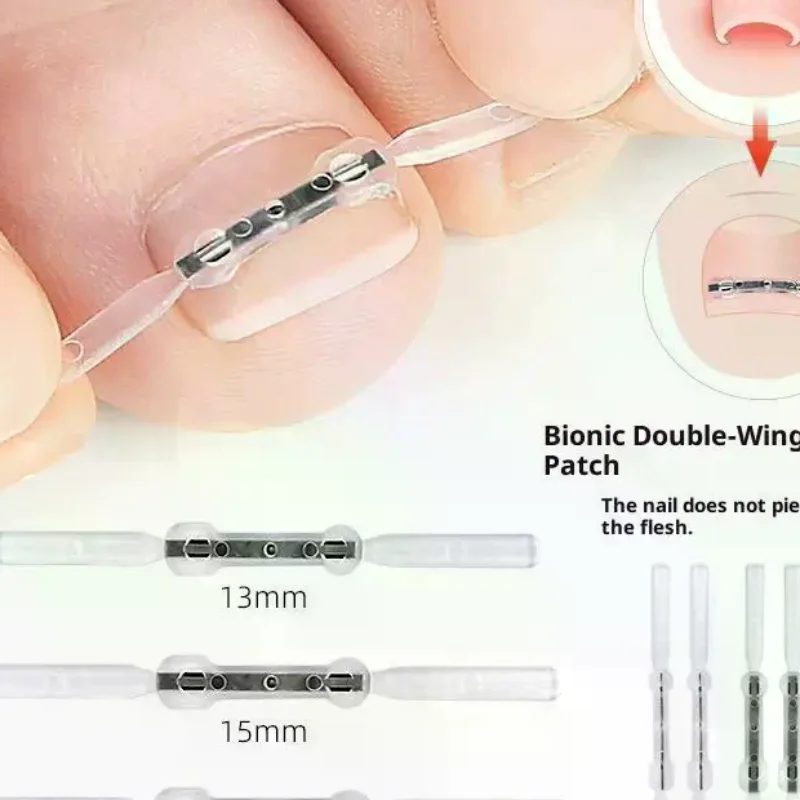 Werkzeuge zur Korrektur eingewachsener Zehennägel, Pediküre, Wiederherstellung, Einbettung der Zehennägel, professionelle Clip-Klammer zur Glättung eingewachsener Zehennägel